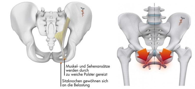 Gesäß, Sitzknochen und Taubheitsgefühle [2026]- Fahrrad & Gesundheit
